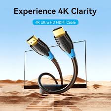 Vention HDMI 2.0 Cable (1.5m, Black) – AACBG High-Speed 4K Ultra HD Cable for TV, Monitor & Gaming